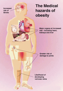 Riscuri obezitate